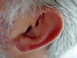 Acupuncture in Exeter: ear acupuncture for spinal pain.