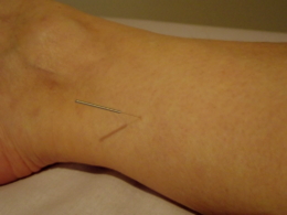 The acupuncture point SP-6, just above the ankle.
