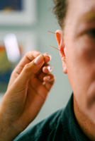Acupuncture in Exeter: ear acupuncture reduces pain after surgery